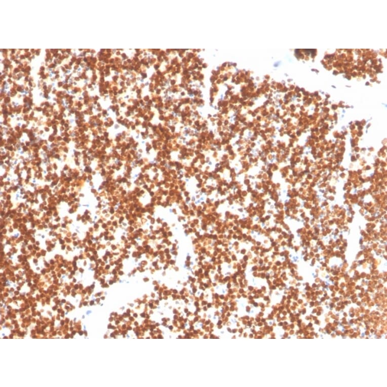 Immunohistochemistry - Anti-Steroidogenic Factor 1 Antibody [NR5A1/3397] - BSA and Azide free (A251837) - Antibodies.com