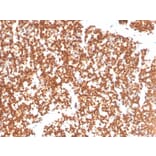 Immunohistochemistry - Anti-Steroidogenic Factor 1 Antibody [NR5A1/3397] - BSA and Azide free (A251837) - Antibodies.com