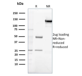 SDS-PAGE - Anti-Gastrin Antibody [GAST/2632] - BSA and Azide free (A251838) - Antibodies.com