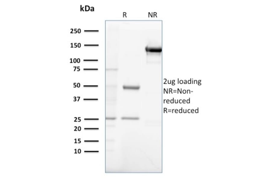 SDS-PAGE - Anti-Gastrin Antibody [GAST/2632] - BSA and Azide free (A251838) - Antibodies.com