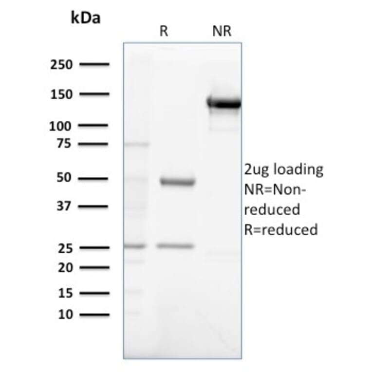 SDS-PAGE - Anti-Gastrin Antibody [GAST/2632] - BSA and Azide free (A251838) - Antibodies.com