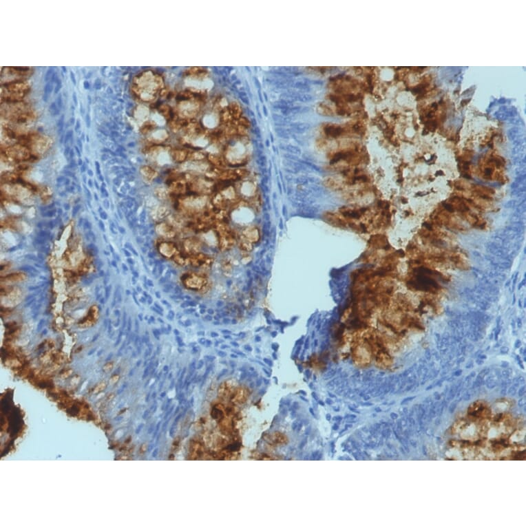 Immunohistochemistry - Anti-Blood Group Antigen Lewis B Antibody [SPM194] - BSA and Azide free (A251843) - Antibodies.com
