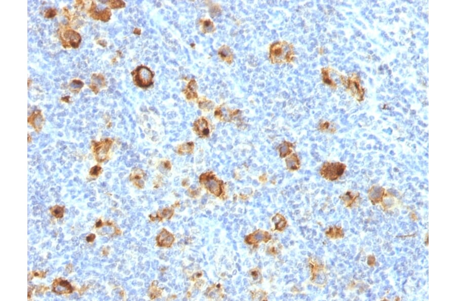 Immunohistochemistry - Anti-CD15 Antibody [FUT4/1478R] - BSA and Azide free (A251853) - Antibodies.com