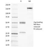 SDS-PAGE - Anti-Ku70 Antibody [KU729] - BSA and Azide free (A251855) - Antibodies.com