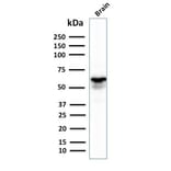 Western Blot - Anti-GAD67 Antibody [GAD1/2391] - BSA and Azide free (A251856) - Antibodies.com