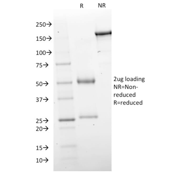 SDS-PAGE - Anti-GAD67 Antibody [GAD1/2563] - BSA and Azide free (A251857) - Antibodies.com