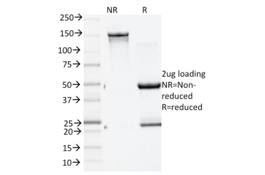 SDS-PAGE - Anti-GAD65 Antibody [GAD2/1960] - BSA and Azide free (A251858) - Antibodies.com