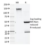 SDS-PAGE - Anti-GAD65 Antibody [GAD2/1960] - BSA and Azide free (A251858) - Antibodies.com