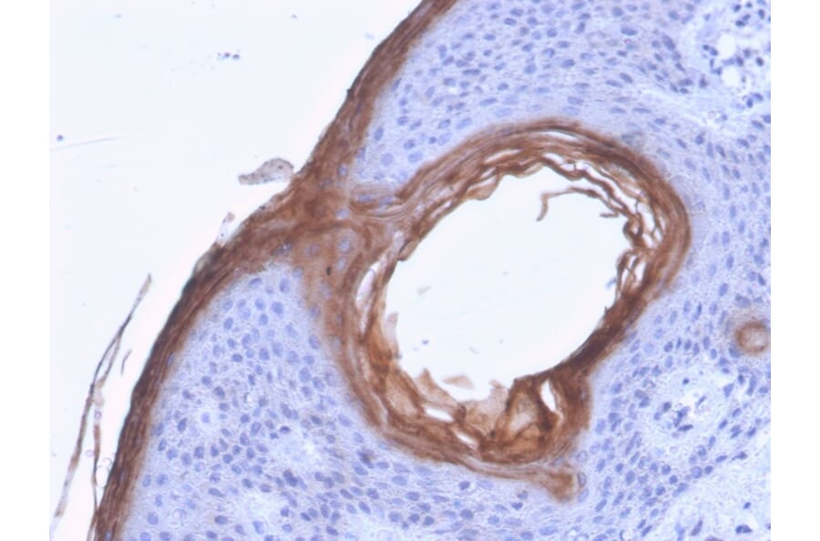 Immunohistochemistry - Anti-Kallikrein 5 Antibody [KLK5/3841] - BSA and Azide free (A251860) - Antibodies.com