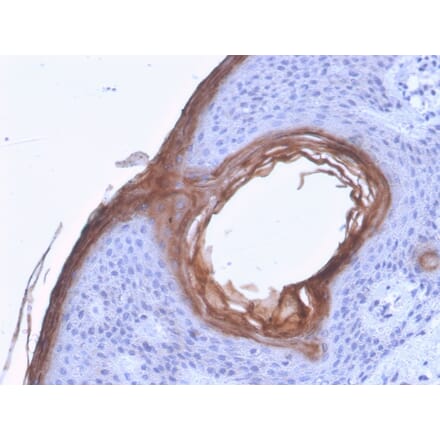 Immunohistochemistry - Anti-Kallikrein 5 Antibody [KLK5/3841] - BSA and Azide free (A251860) - Antibodies.com