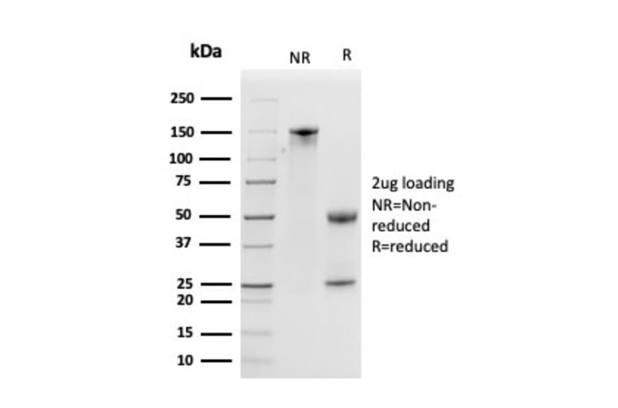 SDS-PAGE - Anti-Kallikrein 5 Antibody [KLK5/3841] - BSA and Azide free (A251860) - Antibodies.com