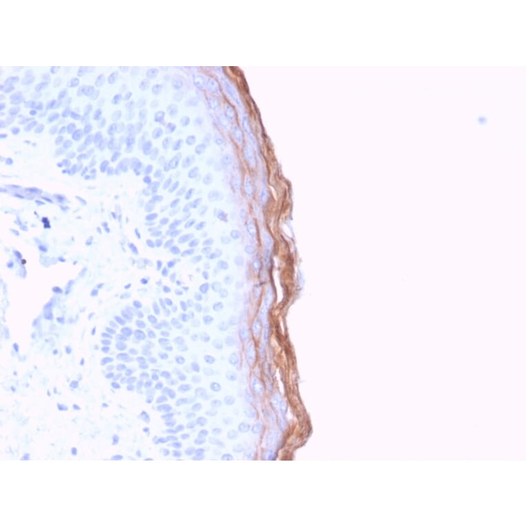 Immunohistochemistry - Anti-Kallikrein 5 Antibody [KLK5/3841] - BSA and Azide free (A251860) - Antibodies.com