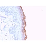 Immunohistochemistry - Anti-Kallikrein 5 Antibody [KLK5/3841] - BSA and Azide free (A251860) - Antibodies.com