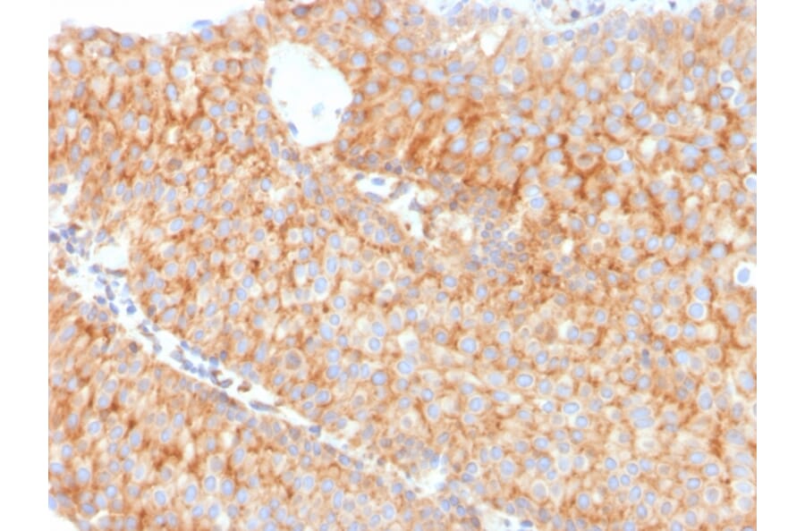Immunohistochemistry - Anti-SERBP1 Antibody [SERBP1/3491] - BSA and Azide free (A251864) - Antibodies.com