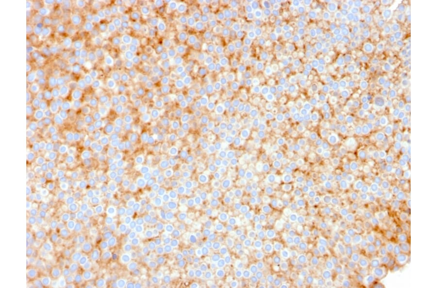 Immunohistochemistry - Anti-SERBP1 Antibody [SERBP1/3491] - BSA and Azide free (A251864) - Antibodies.com