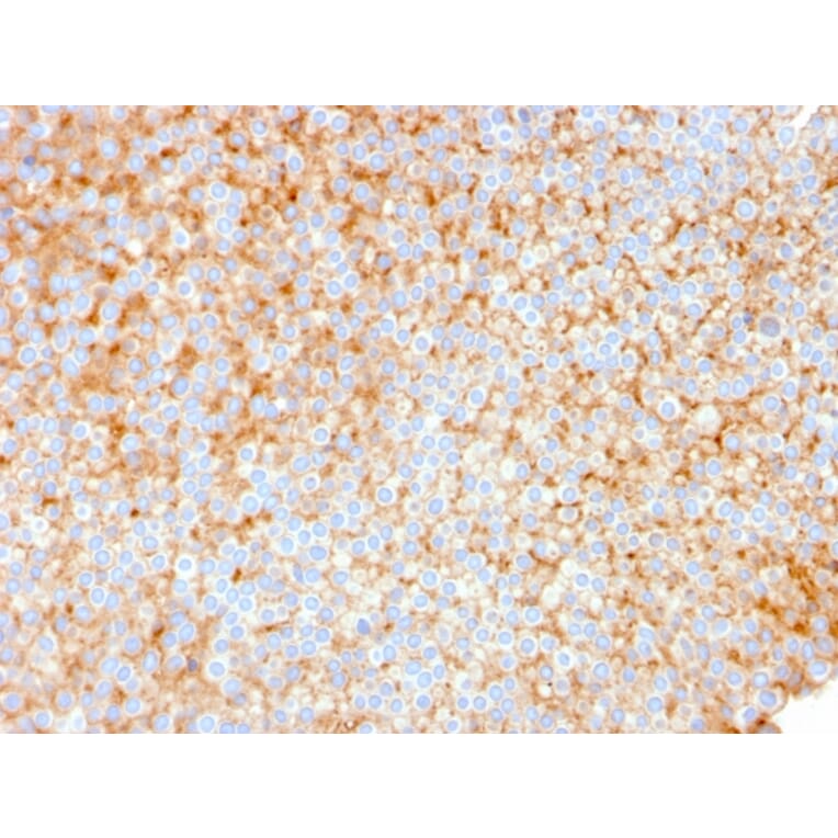Immunohistochemistry - Anti-SERBP1 Antibody [SERBP1/3491] - BSA and Azide free (A251864) - Antibodies.com