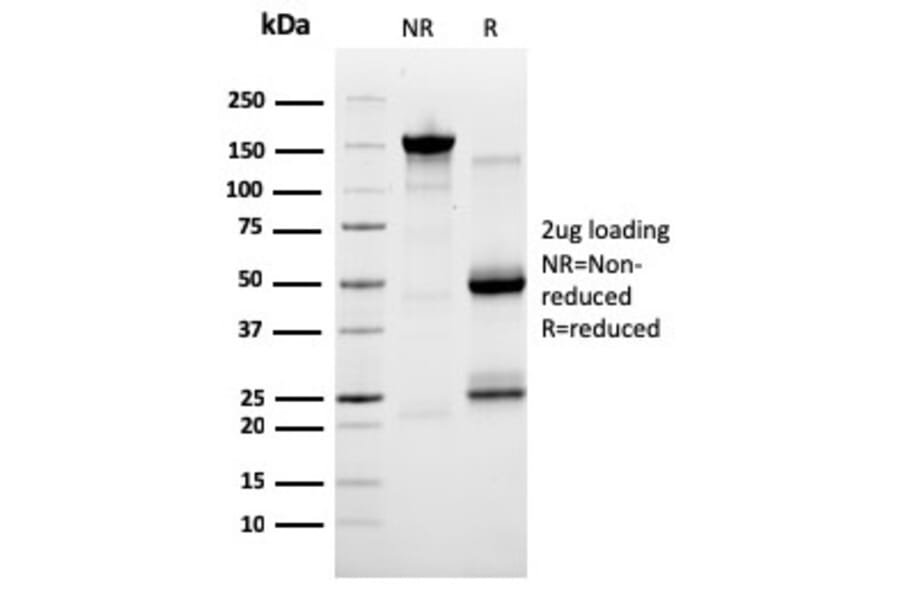 SDS-PAGE - Anti-SERBP1 Antibody [SERBP1/3491] - BSA and Azide free (A251864) - Antibodies.com