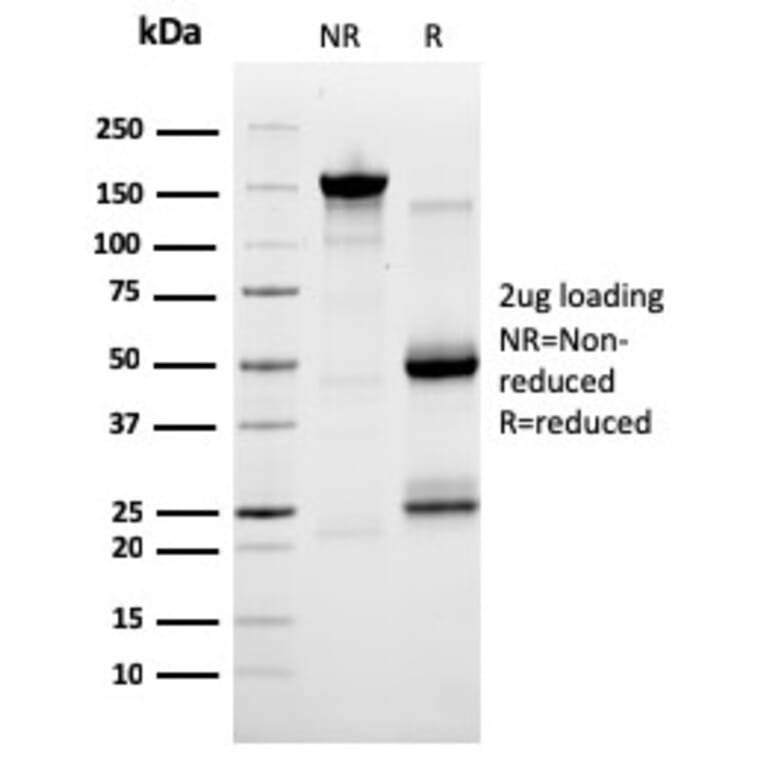 SDS-PAGE - Anti-SERBP1 Antibody [SERBP1/3491] - BSA and Azide free (A251864) - Antibodies.com
