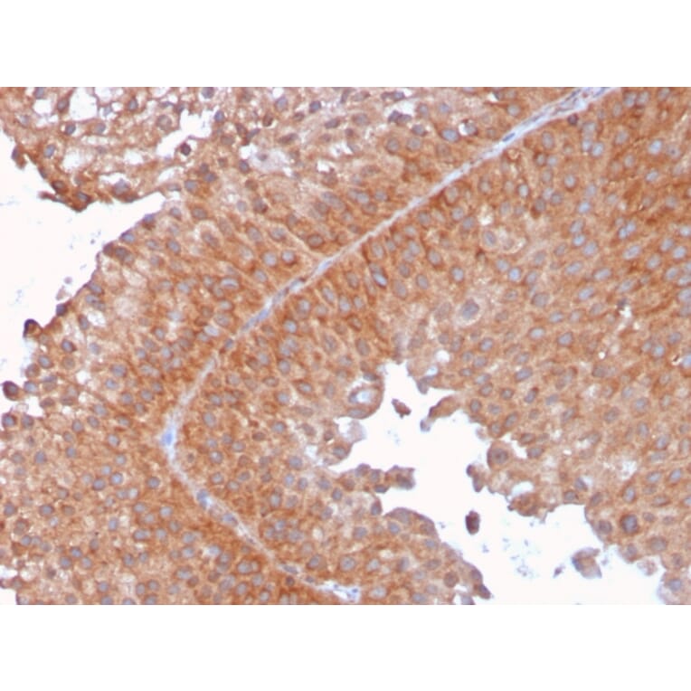 Immunohistochemistry - Anti-SERBP1 Antibody [SERBP1/3492] - BSA and Azide free (A251865) - Antibodies.com