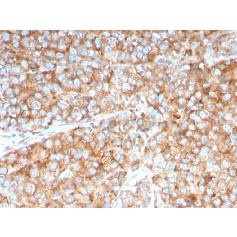 Immunohistochemistry - Anti-SERBP1 Antibody [SERBP1/3492] - BSA and Azide free (A251865) - Antibodies.com