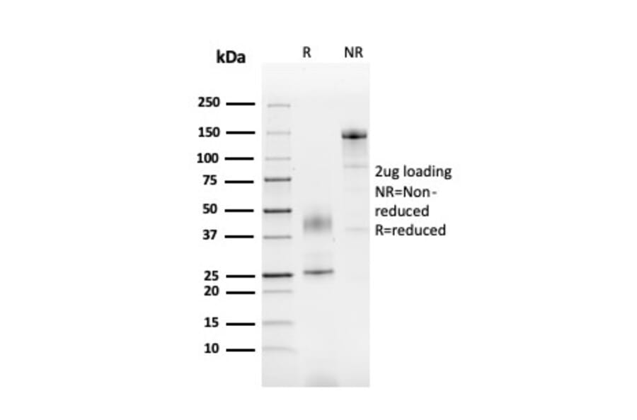 SDS-PAGE - Anti-SERBP1 Antibody [SERBP1/3492] - BSA and Azide free (A251865) - Antibodies.com
