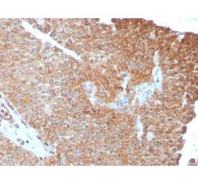 Immunohistochemistry - Anti-SERBP1 Antibody [SERBP1/3493] - BSA and Azide free (A251866) - Antibodies.com