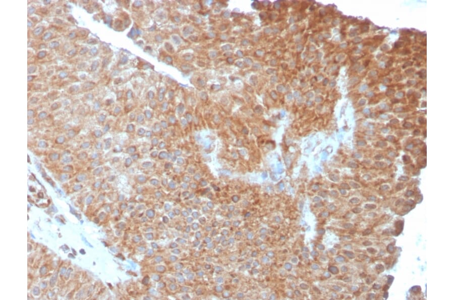 Immunohistochemistry - Anti-SERBP1 Antibody [SERBP1/3493] - BSA and Azide free (A251866) - Antibodies.com