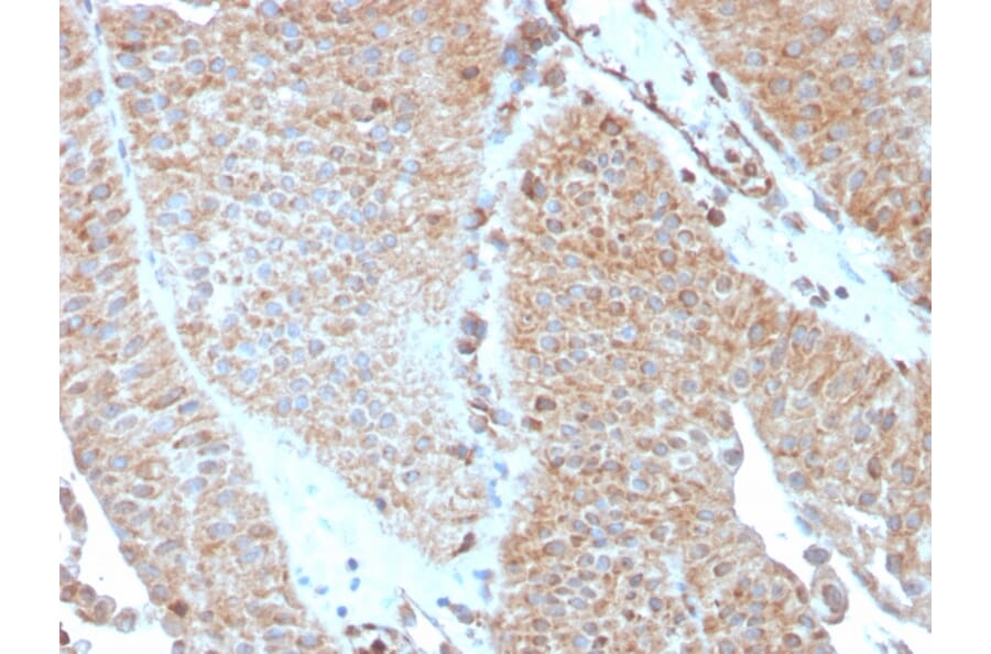 Immunohistochemistry - Anti-SERBP1 Antibody [SERBP1/3493] - BSA and Azide free (A251866) - Antibodies.com