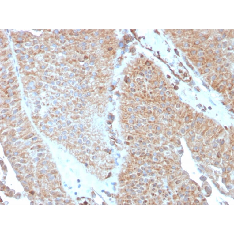 Immunohistochemistry - Anti-SERBP1 Antibody [SERBP1/3493] - BSA and Azide free (A251866) - Antibodies.com