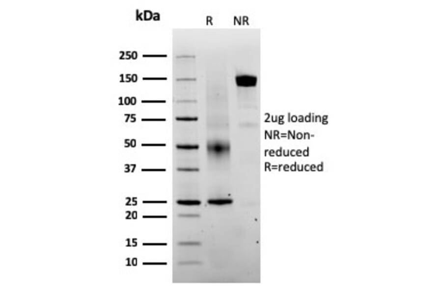 SDS-PAGE - Anti-SERBP1 Antibody [SERBP1/3493] - BSA and Azide free (A251866) - Antibodies.com