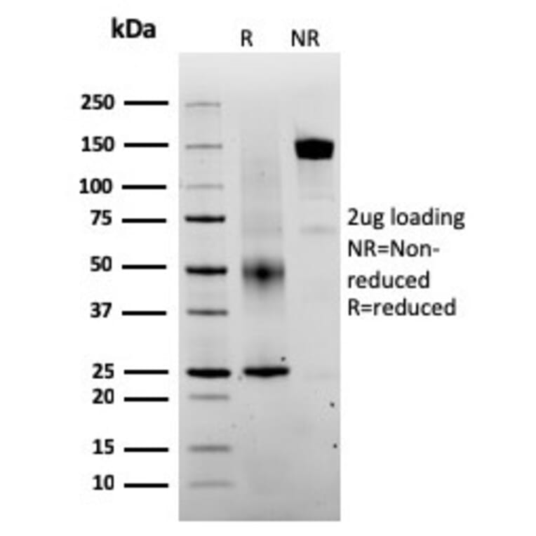 SDS-PAGE - Anti-SERBP1 Antibody [SERBP1/3493] - BSA and Azide free (A251866) - Antibodies.com