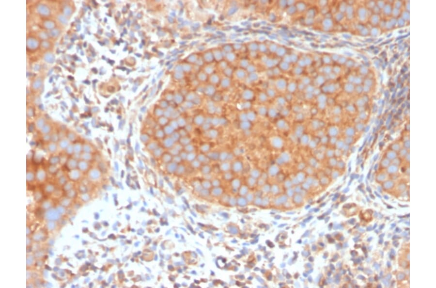 Immunohistochemistry - Anti-SERBP1 Antibody [SERBP1/3494] - BSA and Azide free (A251867) - Antibodies.com