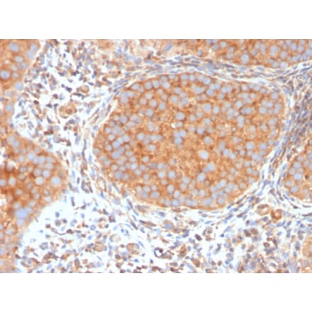 Immunohistochemistry - Anti-SERBP1 Antibody [SERBP1/3494] - BSA and Azide free (A251867) - Antibodies.com