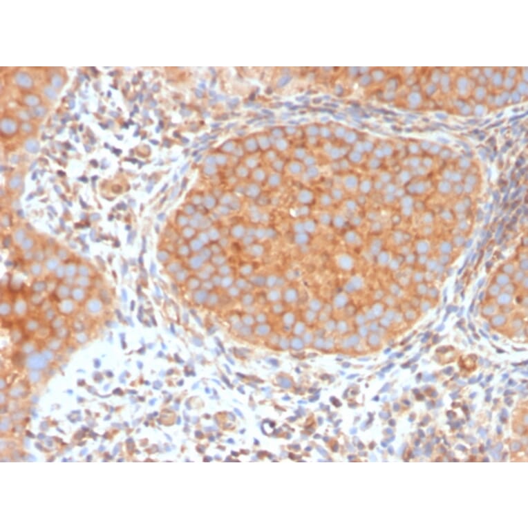 Immunohistochemistry - Anti-SERBP1 Antibody [SERBP1/3494] - BSA and Azide free (A251867) - Antibodies.com