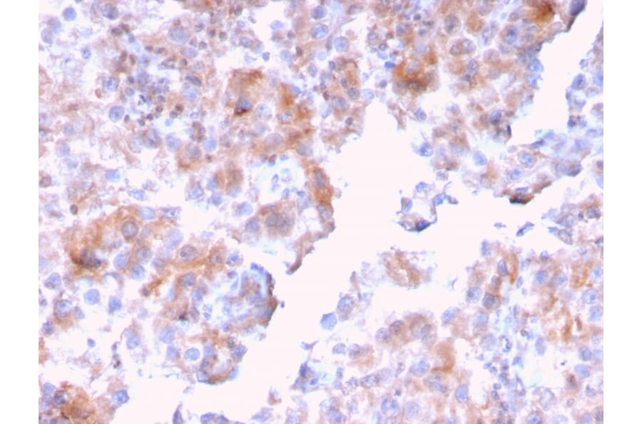 Immunohistochemistry - Anti-SERBP1 Antibody [SERBP1/3494] - BSA and Azide free (A251867) - Antibodies.com