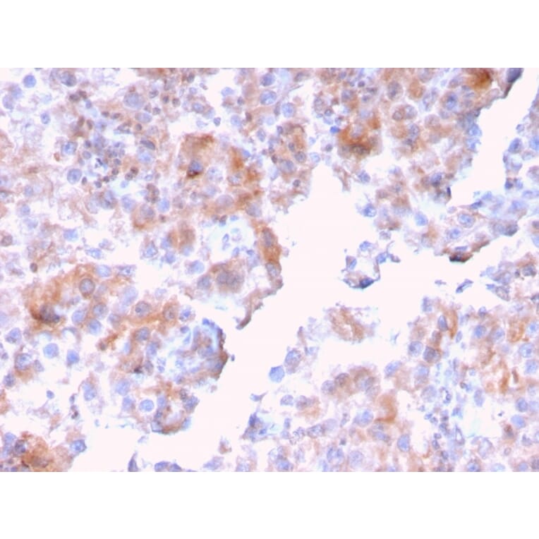Immunohistochemistry - Anti-SERBP1 Antibody [SERBP1/3494] - BSA and Azide free (A251867) - Antibodies.com