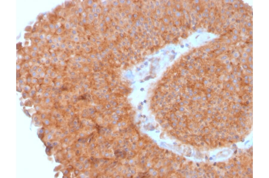 Immunohistochemistry - Anti-SERBP1 Antibody [SERBP1/3495] - BSA and Azide free (A251868) - Antibodies.com