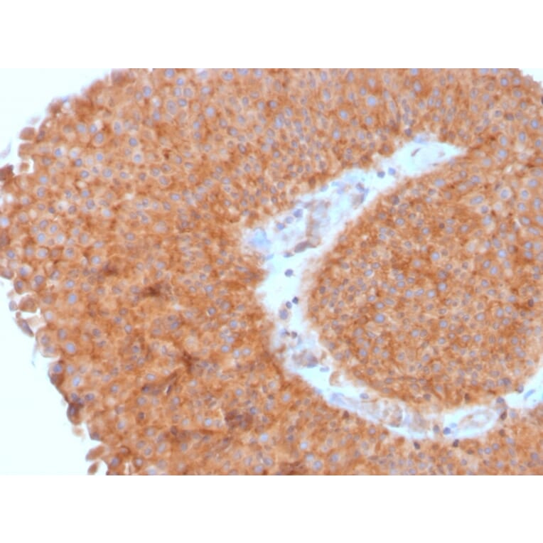 Immunohistochemistry - Anti-SERBP1 Antibody [SERBP1/3495] - BSA and Azide free (A251868) - Antibodies.com