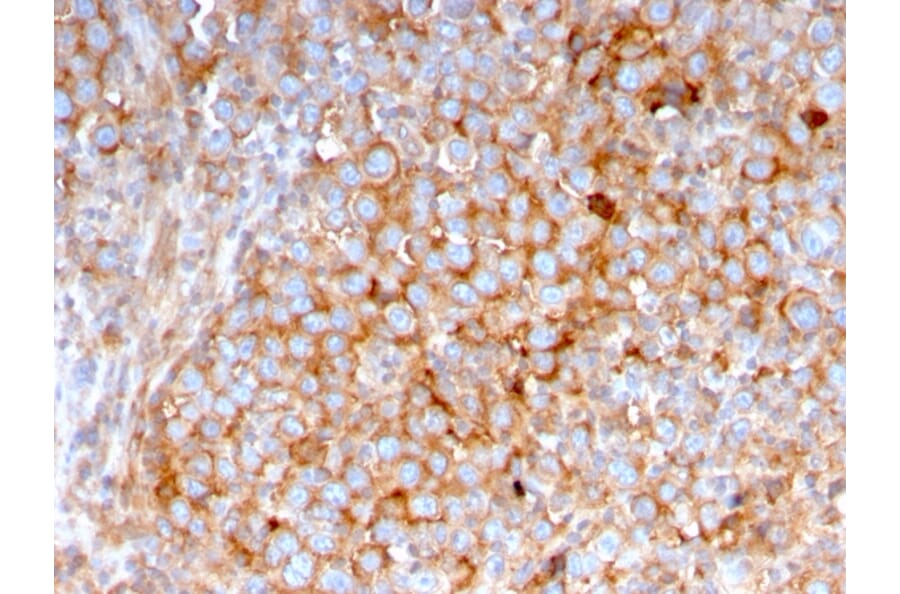 Immunohistochemistry - Anti-SERBP1 Antibody [SERBP1/3495] - BSA and Azide free (A251868) - Antibodies.com