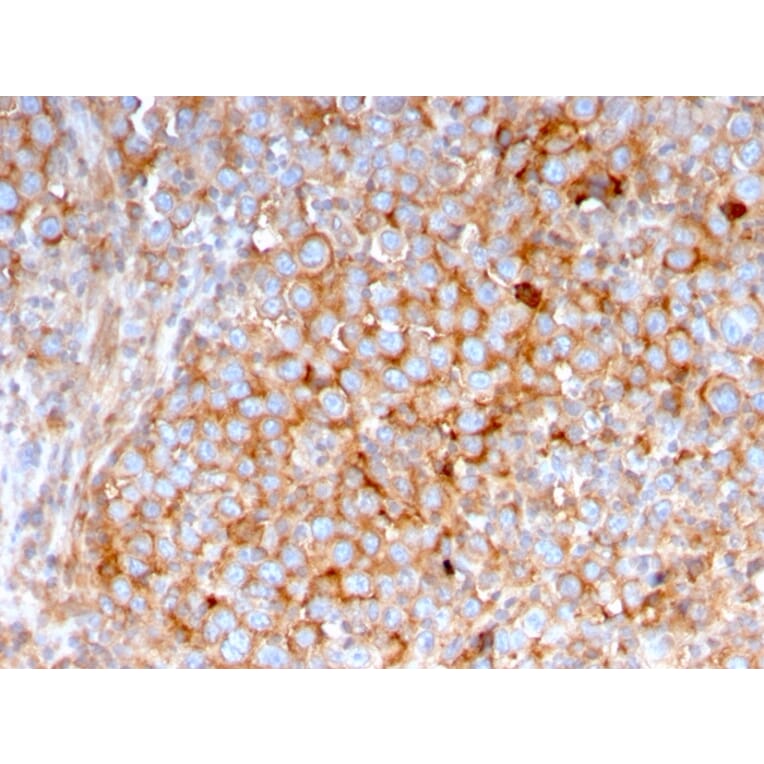 Immunohistochemistry - Anti-SERBP1 Antibody [SERBP1/3495] - BSA and Azide free (A251868) - Antibodies.com