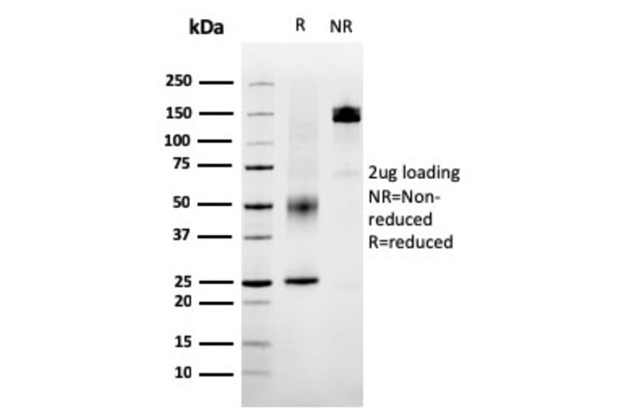 SDS-PAGE - Anti-SERBP1 Antibody [SERBP1/3495] - BSA and Azide free (A251868) - Antibodies.com