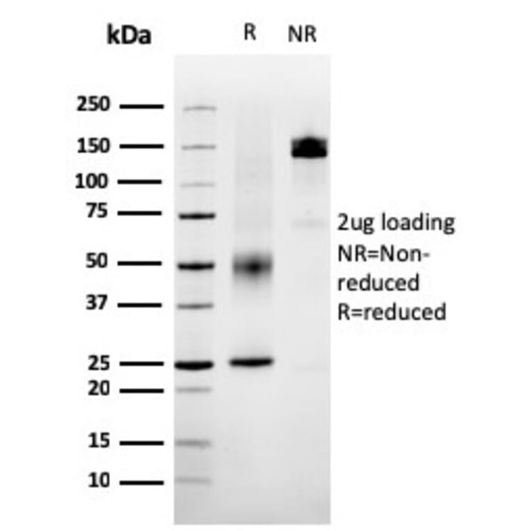 SDS-PAGE - Anti-SERBP1 Antibody [SERBP1/3495] - BSA and Azide free (A251868) - Antibodies.com