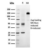 SDS-PAGE - Anti-SERBP1 Antibody [SERBP1/3495] - BSA and Azide free (A251868) - Antibodies.com