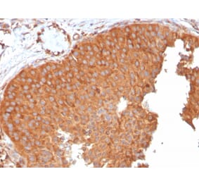 Immunohistochemistry - Anti-SERBP1 Antibody [SERBP1/3496] - BSA and Azide free (A251869) - Antibodies.com