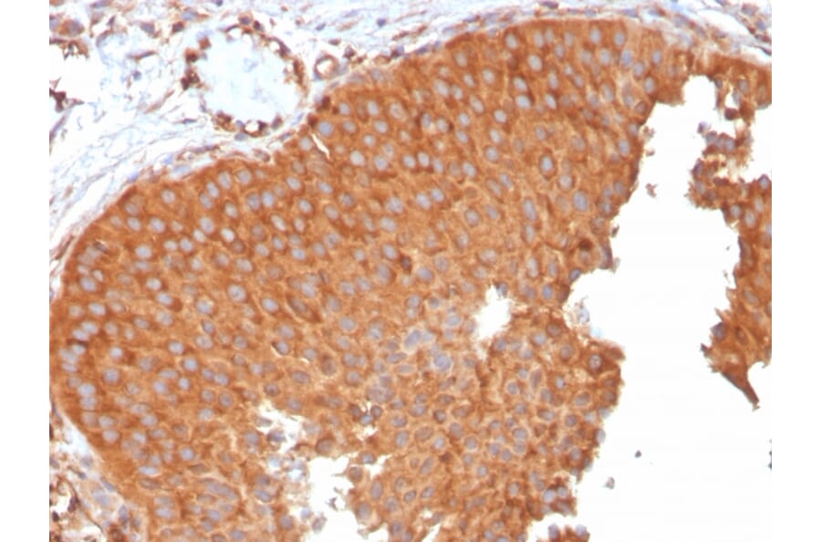 Immunohistochemistry - Anti-SERBP1 Antibody [SERBP1/3496] - BSA and Azide free (A251869) - Antibodies.com