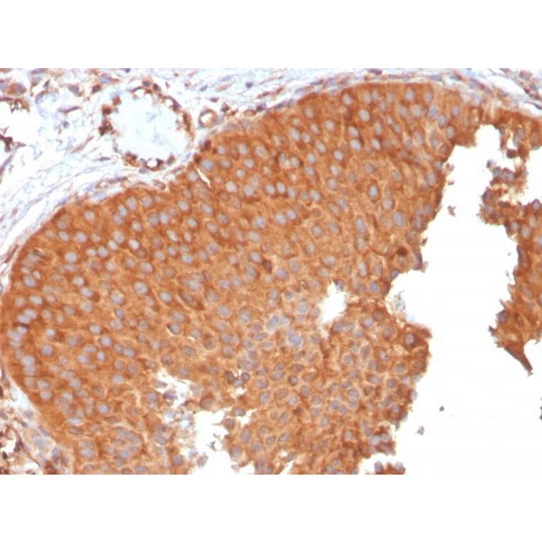 Immunohistochemistry - Anti-SERBP1 Antibody [SERBP1/3496] - BSA and Azide free (A251869) - Antibodies.com