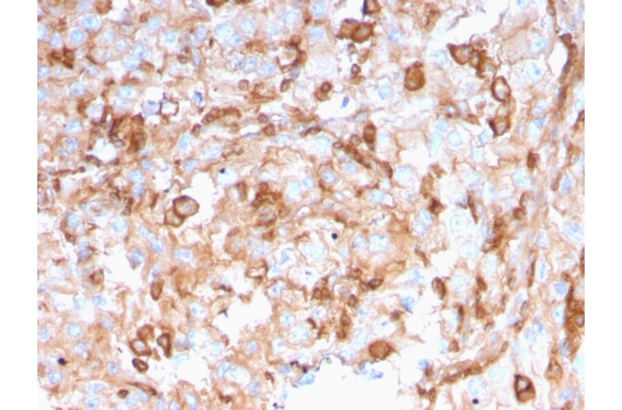 Immunohistochemistry - Anti-SERBP1 Antibody [SERBP1/3496] - BSA and Azide free (A251869) - Antibodies.com