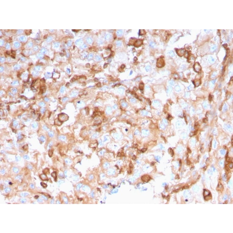 Immunohistochemistry - Anti-SERBP1 Antibody [SERBP1/3496] - BSA and Azide free (A251869) - Antibodies.com