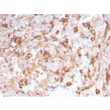 Immunohistochemistry - Anti-SERBP1 Antibody [SERBP1/3496] - BSA and Azide free (A251869) - Antibodies.com