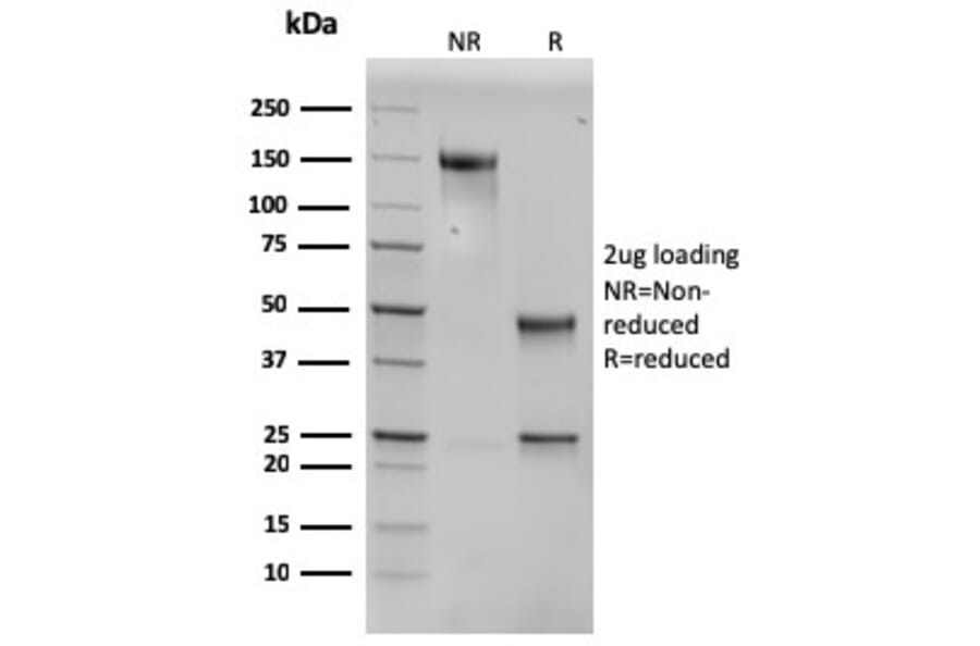 SDS-PAGE - Anti-SERBP1 Antibody [SERBP1/3496] - BSA and Azide free (A251869) - Antibodies.com